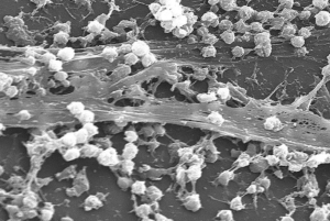 rompere il biofilm